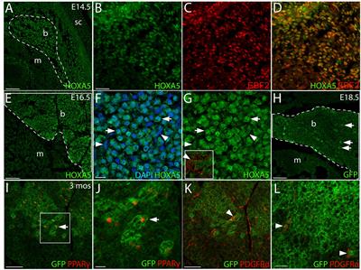 HOXA5 Participates in Brown Adipose Tissue and Epaxial Skeletal Muscle Patterning and in Brown Adipocyte Differentiation